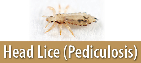 Head Lice